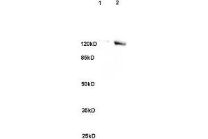 L1 rat brain, L2 human colon carcinoma lysates probed (ABIN741705) at 1:200 in 4 °C. (SREBF2 抗体)