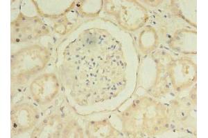 Immunohistochemistry of paraffin-embedded human kidney tissue using ABIN7155229 at dilution of 1:100 (HIATL1 抗体  (AA 450-506))