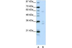 WB Suggested Anti-ZNF440 Antibody Titration:  2. (ZNF440 抗体  (N-Term))