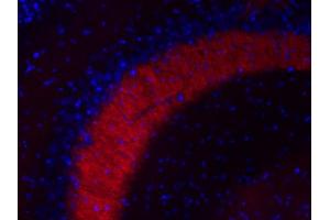 Indirect immunofluorescence labeling of a PFA fixed mouse hippocampus section (dilution 1 : 200; red). (MAL2 抗体  (AA 13-28))