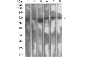 Western Blotting (WB) image for anti-SET Domain Containing (Lysine Methyltransferase) 7 (SETD7) (AA 107-366) antibody (ABIN7193392)