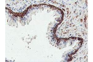 Image no. 1 for anti-phosphofructokinase, Platelet (PFKP) antibody (ABIN1500160) (PFKP 抗体)