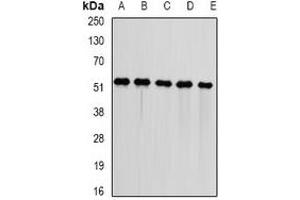 Western blot analysis of DNAJA3 expression in Jurkat (A), HepG2 (B), mouse kidney (C), mouse heart (D), rat liver (E) whole cell lysates. (DNAJA3 抗体)