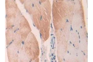 Detection of LGMN in Mouse Skeletal muscle Tissue using Polyclonal Antibody to Legumain (LGMN) (LGMN 抗体  (AA 18-435))