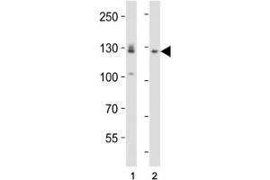Western blot analysis of lysate from (1) A431 and (2) U-87 MG cell line using EPHA2 antibody diluted at 1:1000.