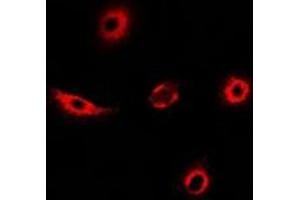 Immunofluorescent analysis of Transgelin-2 staining in MCF7 cells. (TAGLN2 抗体)