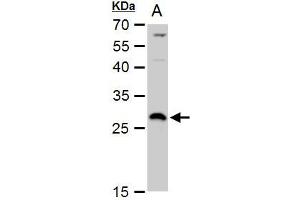 WB Image DCK antibody detects DCK protein by western blot analysis. (DCK 抗体  (Center))