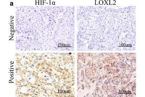 Immunohistochemistry (IHC) image for anti-Lysyl Oxidase-Like 2 (LOXL2) antibody (ABIN2856034)