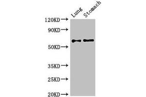 Western Blotting (WB) image for anti-Glutamate Decarboxylase 2 (Pancreatic Islets and Brain, 65kDa) (GAD2) (AA 1-82) antibody (ABIN7153954)