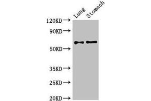 Western Blot Positive WB detected in: Mouse lung tissue, Mouse stomach tissue All lanes: GAD2 antibody at 2. (GAD65 抗体  (AA 1-82))