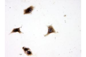 IHC analysis of SQSTM1 using anti-SQSTM1 antibody (ABIN3043937).