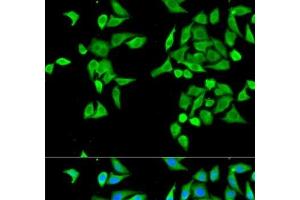 Immunofluorescence analysis of MCF-7 cells using CES2 Polyclonal Antibody (CES2 抗体)