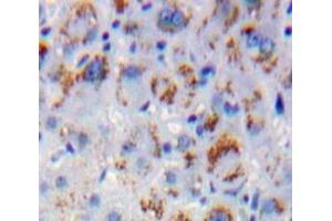 #VALUE! (MAPKSP1 抗体  (AA 1-124))