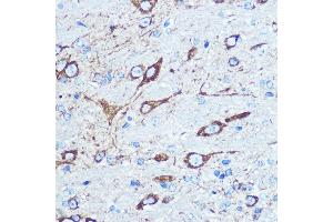 Immunohistochemistry of paraffin-embedded mouse brain using NMD Rabbit pAb (ABIN6133733, ABIN6141400, ABIN6141403 and ABIN6223602) at dilution of 100 (40x lens). (GRIN1/NMDAR1 抗体  (AA 600-700))