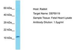 Image no. 1 for anti-Defensin, beta 119 (DEFB119) (N-Term) antibody (ABIN6750557) (DEFB119 抗体  (N-Term))