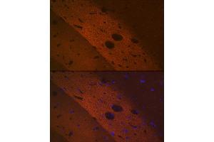Immunofluorescence analysis of rat brain using mGluR2 Rabbit mAb (ABIN1682570, ABIN3017965, ABIN3017966 and ABIN7101551) at dilution of 1:100 (40x lens). (GRM2 抗体)