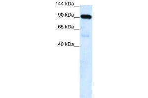 WB Suggested Anti-SUV420H1 Antibody Titration: 0. (SUV420H1 抗体  (C-Term))