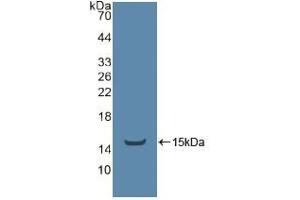 Western blot analysis of recombinant Human ADRbK1. (TEK 抗体  (AA 1-116))