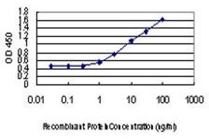 Detection limit for recombinant GST tagged IRF4 is approximately 0. (IRF4 抗体  (AA 342-451))