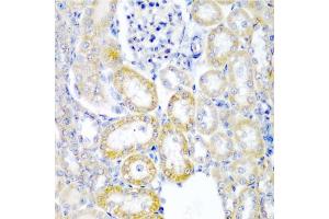 Immunohistochemistry of paraffin-embedded rat kidney using UPF2 antibody. (RENT2/UPF2 抗体)