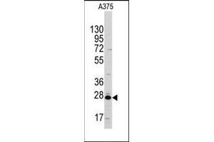 Western blot analysis of anti-CLIC1 Antibody in A375 cell line lysates (35ug/lane).