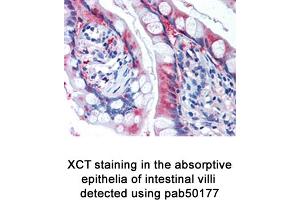 Image no. 2 for anti-Solute Carrier Family 7, (Cationic Amino Acid Transporter, Y+ System) Member 11 (SLC7A11) (AA 1-50), (N-Term) antibody (ABIN363486)