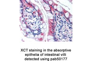 Image no. 2 for anti-Solute Carrier Family 7, (Cationic Amino Acid Transporter, Y+ System) Member 11 (SLC7A11) (AA 1-50), (N-Term) antibody (ABIN363486) (SLC7A11 抗体  (N-Term))