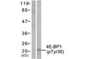 Western Blotting (WB) image for anti-Eukaryotic Translation Initiation Factor 4E Binding Protein 1 (EIF4EBP1) (AA 4-53), (pThr37) antibody (ABIN1531763)