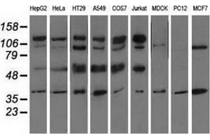 Western blot analysis of extracts (35 µg) from 9 different cell lines by using anti-CD5 monoclonal antibody. (CD5 抗体)
