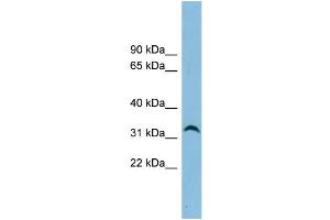 WB Suggested Anti-NXPH4 Antibody Titration: 0. (Neurexophilin 4 抗体  (N-Term))