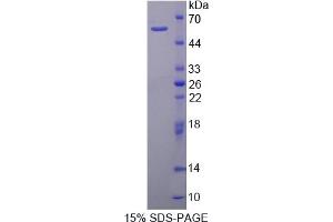 Image no. 1 for Calpain 2 (CAPN2) (AA 45-514) protein (His tag) (ABIN6237785)