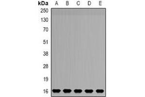 Western blot analysis of NDUFB5 expression in HepG2 (A), SW480 (B), mouse liver (C), mouse brain (D), rat kidney (E) whole cell lysates. (NDUFB5 抗体)