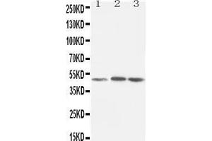Anti-LXR alpha antibody, Western blotting Lane 1: Rat Liver Tissue Lysate Lane 2: MCF-7 Cell Lysate Lane 3: HELA Cell Lysate (NR1H3 抗体  (C-Term))