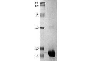 Western Blotting (WB) image for Estrogen Receptor 1 (ESR1) (Transcript Variant 1) protein (His tag) (ABIN2720540)