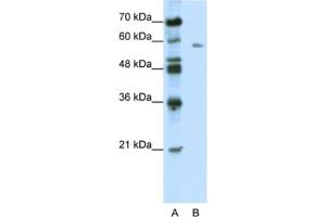 Western Blotting (WB) image for anti-BTB (POZ) Domain Containing 14A (BTBD14A) antibody (ABIN2461017) (BTBD14A 抗体)