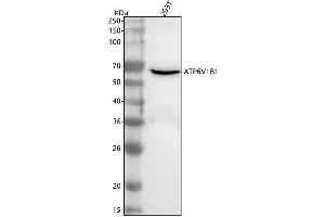 Western blot analysis of ATP6V1B1 using anti-ATP6V1B1 antibody (ABIN7600273).