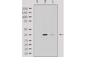 Western blot analysis of extracts from various samples, using IL20RB Antibody. (IL20RB 抗体  (Internal Region))