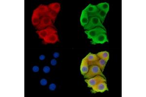 ABIN7095852 and ABIN7099914 staining Hela cells by IF/ICC.