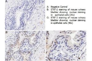 Immunohistochemistry (IHC) image for anti-Signal Transducer and Activator of Transcription 2, 113kDa (STAT2) (pTyr690) antibody (ABIN349594)