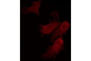 anti-Olfactory Receptor, Family 10, Subfamily D, Member 4 Pseudogene (OR10D4P) antibody