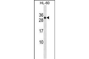 Western Blotting (WB) image for anti-Protein tyrosine Phosphatase, Receptor Type, C Polypeptide-Associated Protein (PTPRCAP) (AA 90-118) antibody (ABIN5537379)