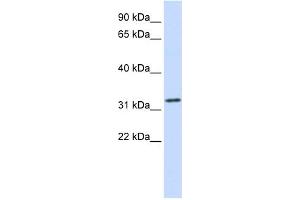 WB Suggested Anti-TPM1 Antibody Titration:  0. (Tropomyosin 抗体  (Middle Region))