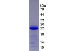 SDS-PAGE analysis of Human SCCA2 Protein. (SERPINB4 蛋白)