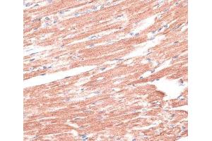Immunohistochemistry (Paraffin-embedded Sections) (IHC (p)) image for anti-LIM Domain Only 4 (LMO4) antibody (ABIN7263255)