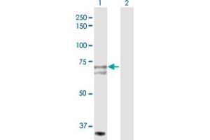 Western Blot analysis of SLC27A1 expression in transfected 293T cell line by SLC27A1 MaxPab polyclonal antibody. (SLC27A1 抗体  (AA 1-646))