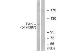 Western blot analysis of extracts from 293 cells treated with EGF 200ng/ml 30', using FAK (Phospho-Tyr397) Antibody. (FAK 抗体  (pTyr397))