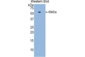 Detection of Recombinant LAMb1, Mouse using Polyclonal Antibody to Laminin Beta 1 (LAMb1) (Laminin beta 1 抗体  (AA 1053-1258))