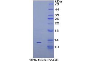 SDS-PAGE of Protein Standard from the Kit (Highly purified E. (PEX2 ELISA 试剂盒)