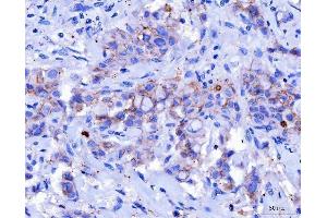 IHC analysis of Desmoglein 2/DSG2 using anti-Desmoglein 2/DSG2 antibody (ABIN7600804).