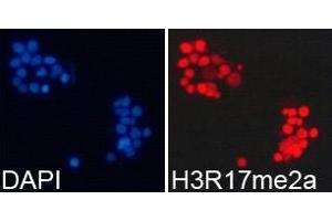 Immunofluorescence analysis of 293T cell using H3R17me2a antibody. (Histone 3 抗体  (H3R17me2a))